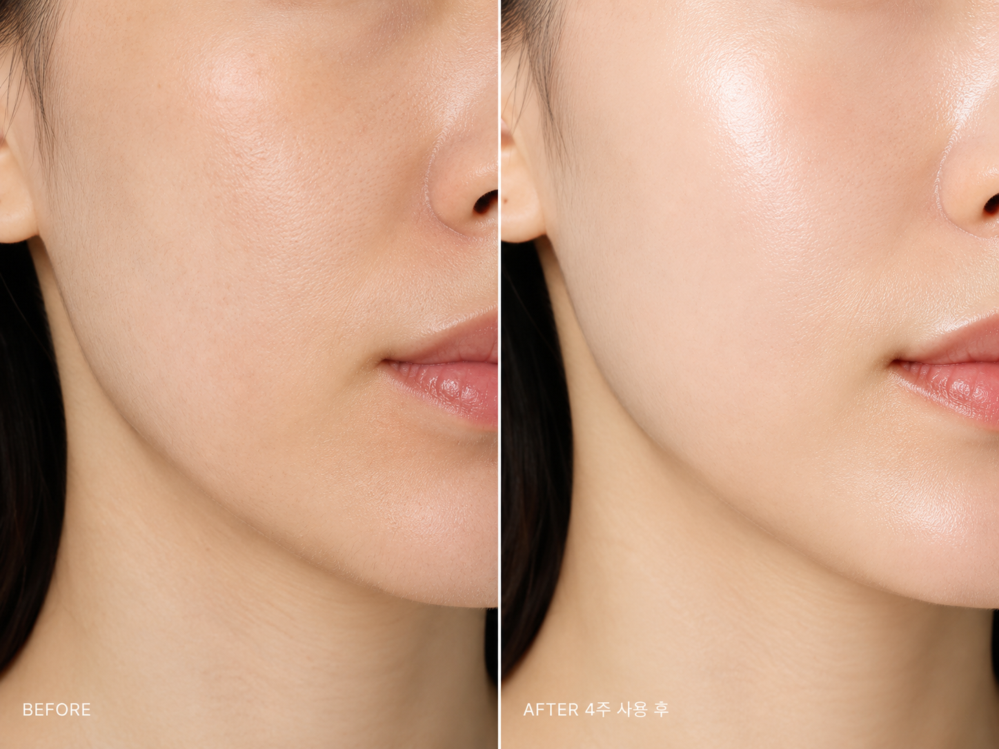 Before & After